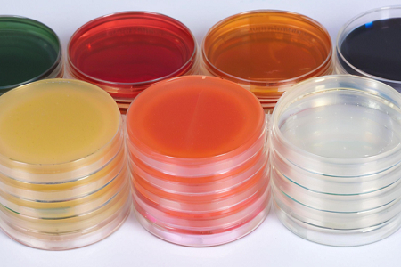 Sbloccare il potenziale del mezzo di agar nutriente per i test microbiologici