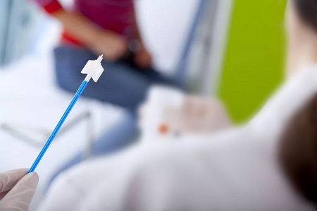 Progressi nello screening del cancro cervicale: il ruolo dei test HPV di auto-collezione