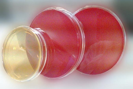 Salmonella Shigella Agar (SS): il mezzo essenziale per l'isolamento dei patogeni