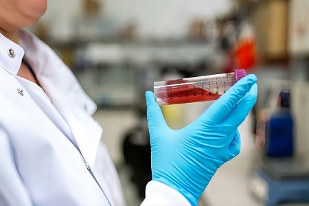 Kit di trasporto di virus (non inattivato)-raccolta di campioni virali sicuri