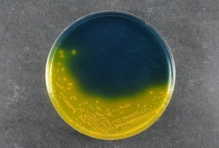 Garantire la sicurezza alimentare: la Salmonella Shigella Agar (SS) di Babio supporta gli standard di rilevamento dei patogeni globali