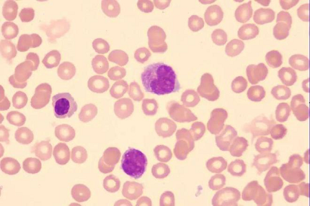 Nadio lancia una soluzione di colorazione Giemsa di alta qualità per i laboratori globali