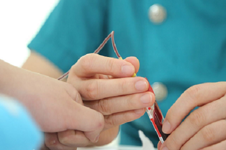 Bastoncini di tampone sterili di alta qualità per una raccolta affidabile dei virus