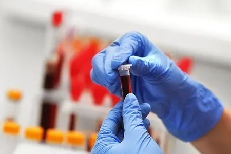 BABIO lancia il test rapido di gravidanza bovina a fluorescenza