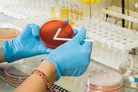 Terreno MacConkey Agar di BABIO: isolamento selettivo premium per la diagnostica microbiologica globale