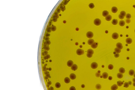 Il brodo BABIO Mueller-Hinton supporta test affidabili di sensibilità antimicrobica